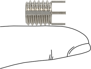 McMaster 93340A415 18 - 8 Stainless Steel Key - Locking Insert with Thin Wall, 5/16" - 18 Thread Size - KVM Tools Inc.KV93340A415